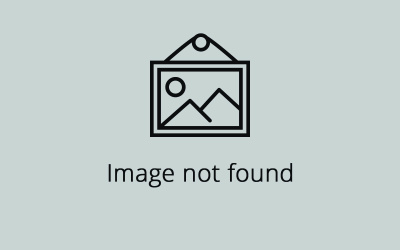 KURSI I ELEKTRONEUROGRAFISË NË PEJË